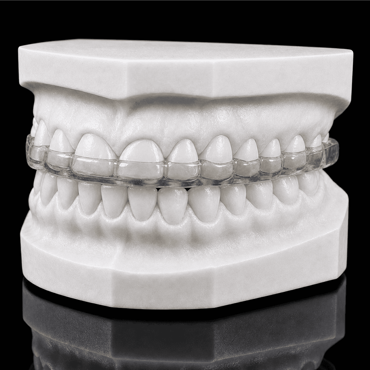 Dental model with clear aligner on teeth.