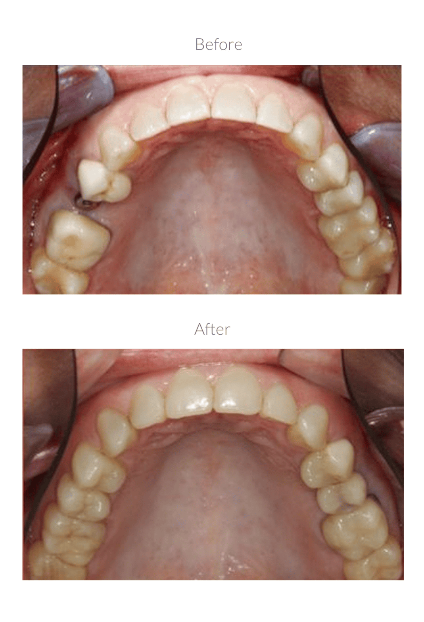 Dental treatment before and after comparison