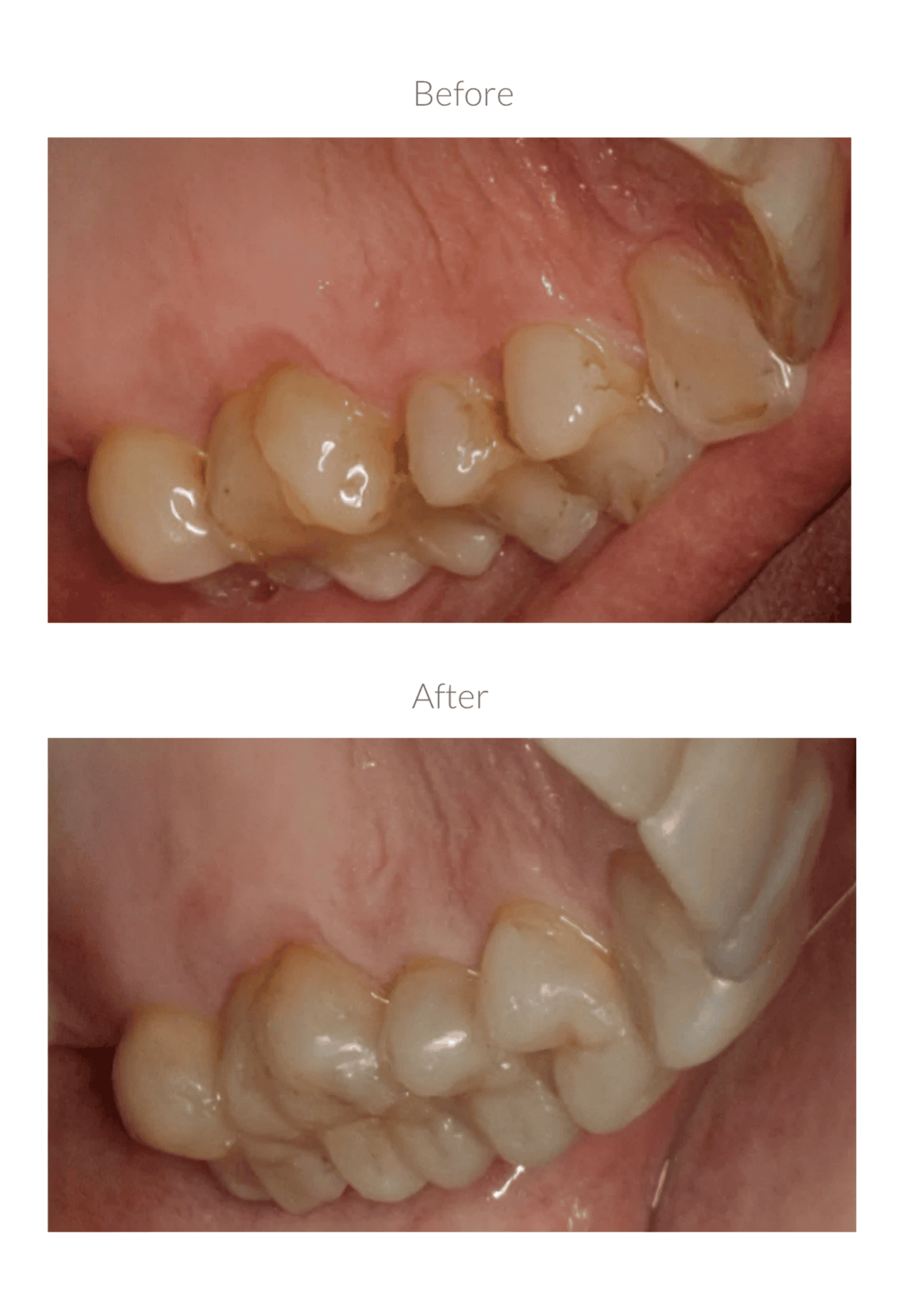Before and after dental procedure image