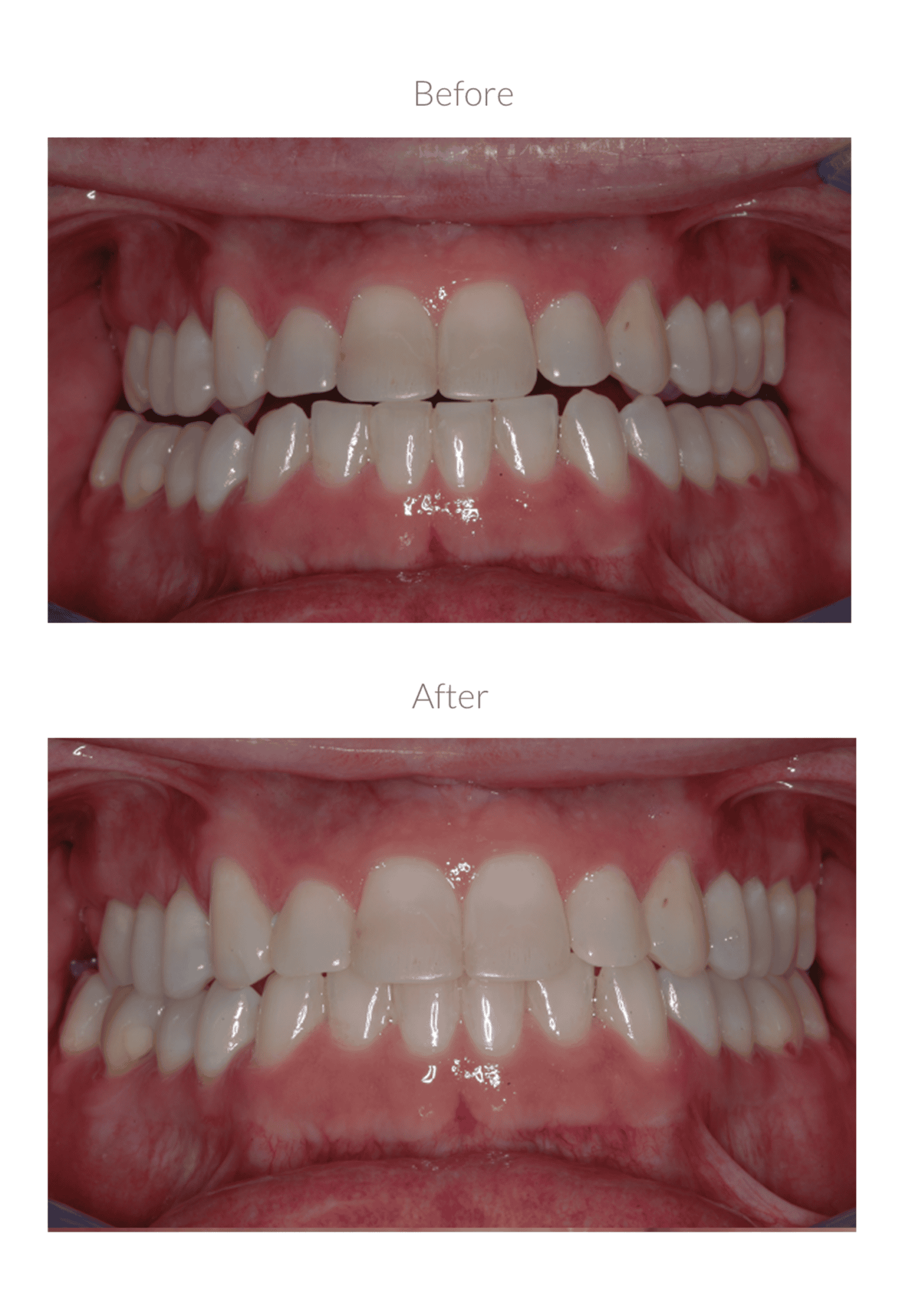 Dental improvement comparison image