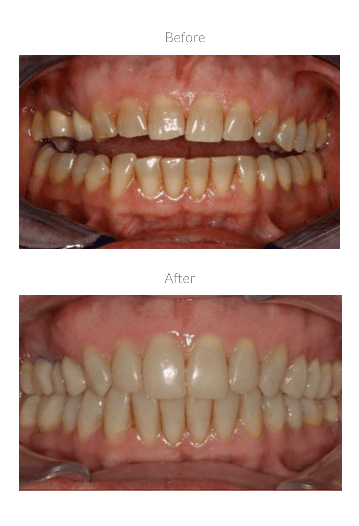 Orthodontic treatment results