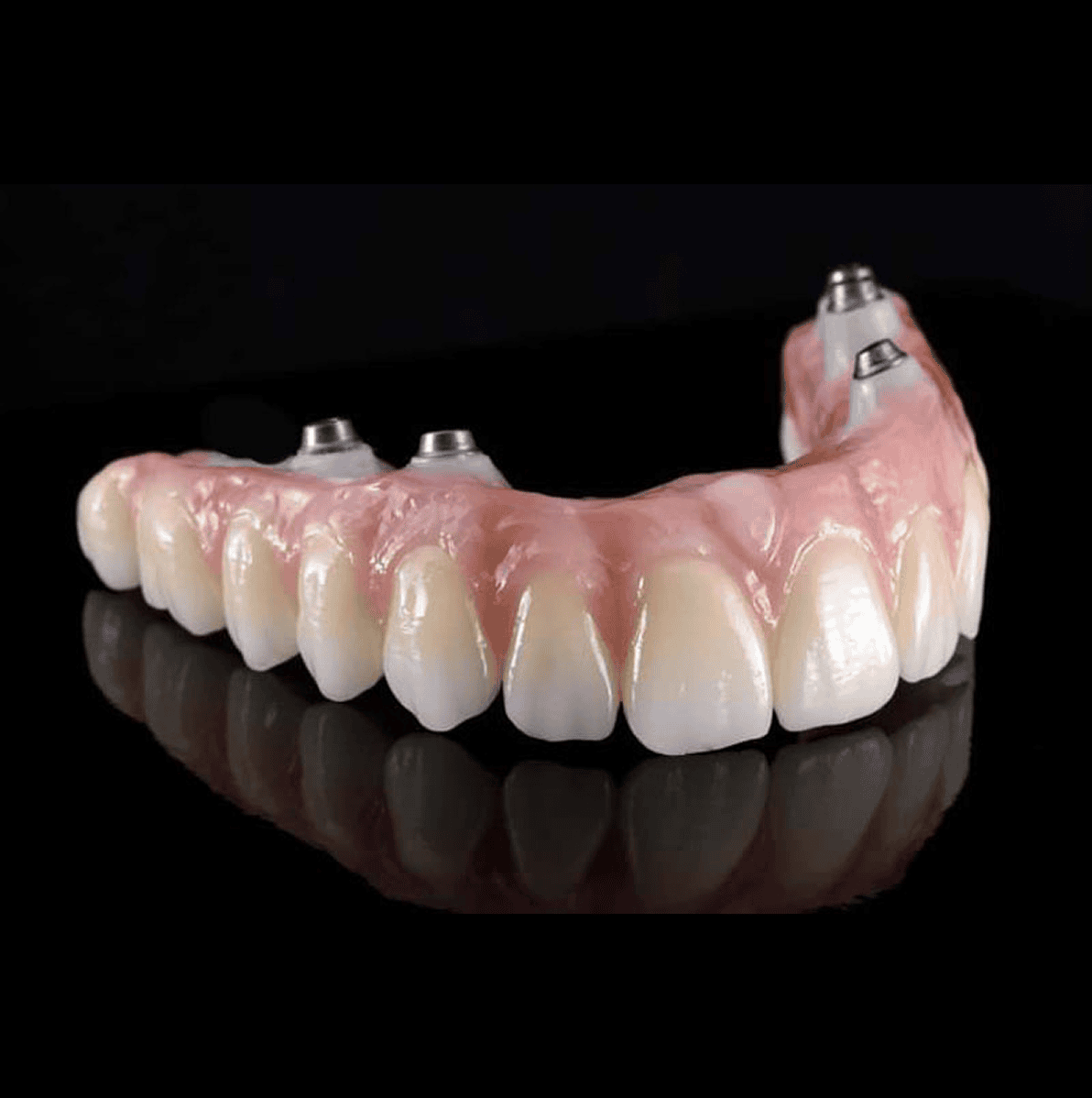 Artificial teeth with implant attachments