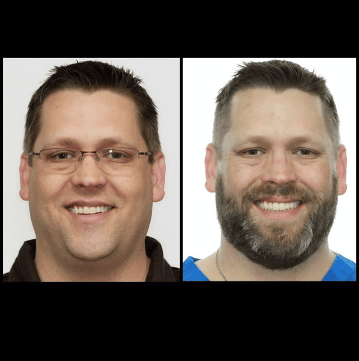 Transformation with and without beard